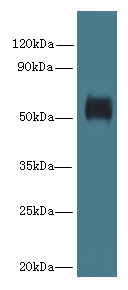 GK5 Polyclonal Antibody