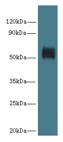 Western blot<br />All lanes: GK5 Polyclonal Antibody at 4ug/ml+ K562 whole cell lysate<br />Goat polyclonal to rabbit at 1/10000 dilution<br />Predicted band size: 59 kDa <br />Observed band size: 59 kDa <br />