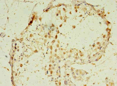 GMNN Polyclonal Antibody