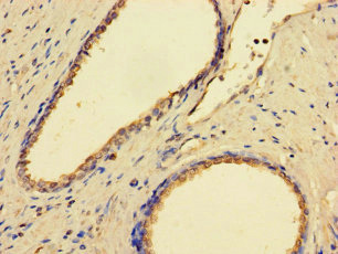 GMPPB Polyclonal Antibody