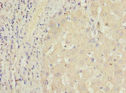 GPR146 Polyclonal Antibody