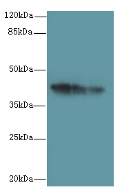 GPR17 Polyclonal Antibody