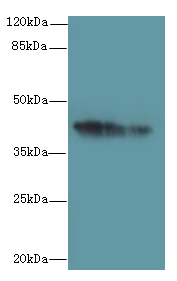 GPR17 Polyclonal Antibody (50 µl)