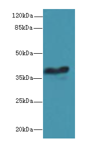 GPR18 Polyclonal Antibody (50 µl)