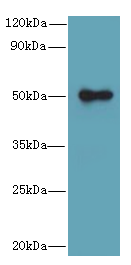 GSDMB Polyclonal Antibody