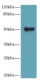 GSDMB Polyclonal Antibody (100 µl)