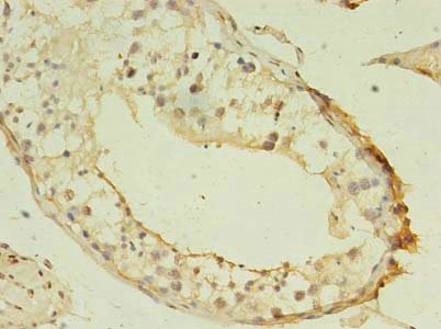 GSTT1 Polyclonal Antibody