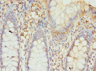 GTF3C6 Polyclonal Antibody
