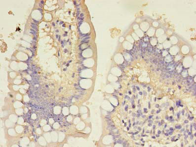 HBD Polyclonal Antibody