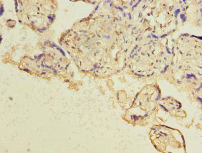 HBE1 Polyclonal Antibody