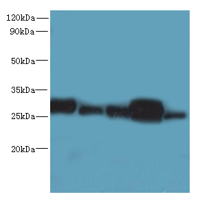 HDHD3 Polyclonal Antibody