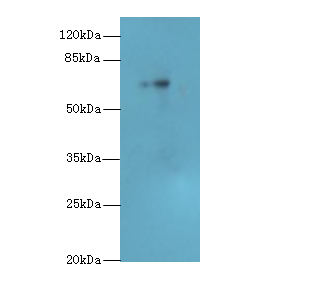 HEATR9 Polyclonal Antibody
