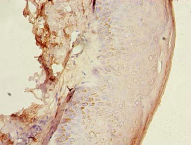 HEMK1 Polyclonal Antibody