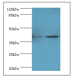 HIF1AN Polyclonal Antibody