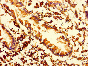 HLA-DMA Polyclonal Antibody