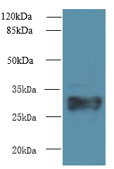 HLA-DRB4 Polyclonal Antibody