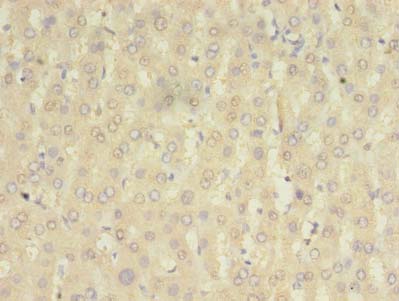 HOMER2 Polyclonal Antibody