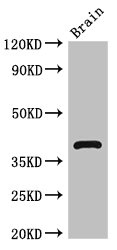 HOMER3 Polyclonal Antibody