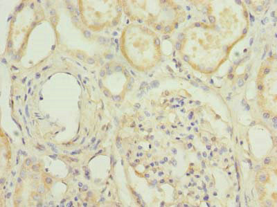 HPCAL1 Polyclonal Antibody (20 µl)