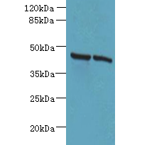 HSDL2 Polyclonal Antibody
