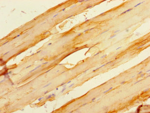 HSPB7 Polyclonal Antibody