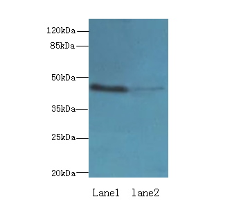 IGSF11 Polyclonal Antibody