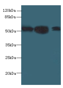 IMPDH2 Polyclonal Antibody