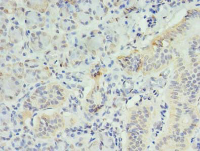 INPP1 Polyclonal Antibody