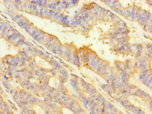 ITGA2 Polyclonal Antibody