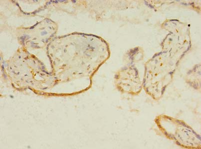 ITIH5 Polyclonal Antibody