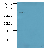 KATNAL2 Polyclonal Antibody