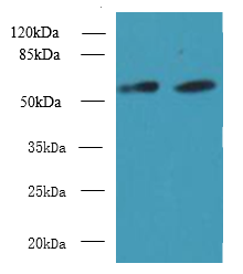 KBTBD4 Polyclonal Antibody (100 µl)