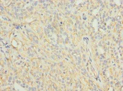 KCNH7 Polyclonal Antibody