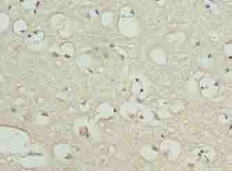 KIAA0319L Polyclonal Antibody