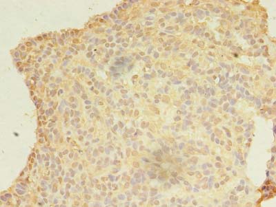 KIAA1257 Polyclonal Antibody