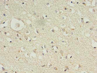 KIF12 Polyclonal Antibody