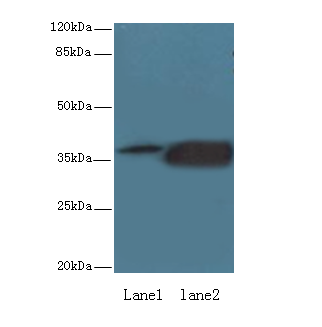 KLHDC8A Polyclonal Antibody