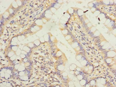Immunohistochemistry of paraffin-embedded human small intestine tissue using KLHDC8A Polyclonal Antibody at dilution of 1:100