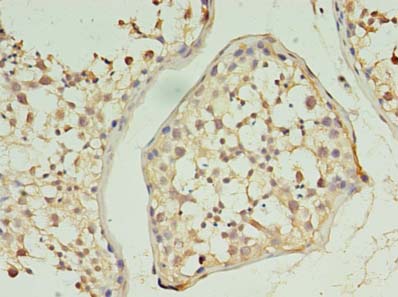 KLHL12 Polyclonal Antibody