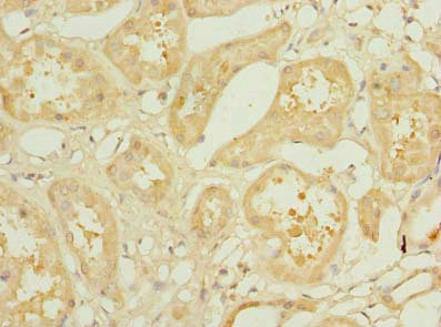 KLHL42 Polyclonal Antibody