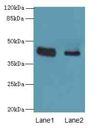 KRT33B Polyclonal Antibody