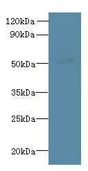 L2HGDH Polyclonal Antibody
