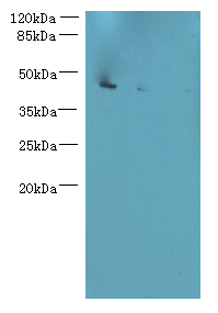 L3HYPDH Polyclonal Antibody