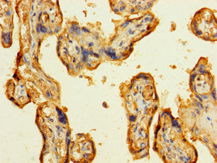 LAMA5 Polyclonal Antibody