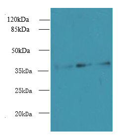 LDAH Polyclonal Antibody