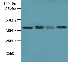 LGALS12 Polyclonal Antibody