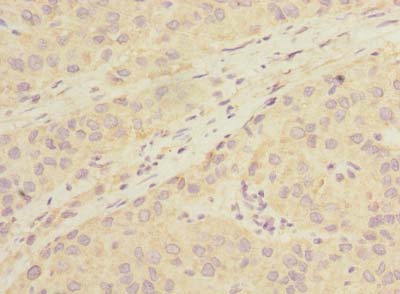 LHPP Polyclonal Antibody