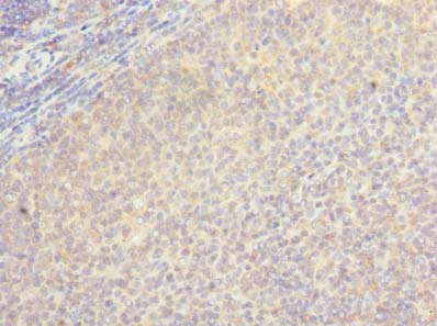 LOH12CR1 Polyclonal Antibody