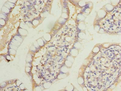 LRRC39 Polyclonal Antibody