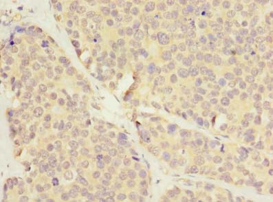 LRRC8E Polyclonal Antibody